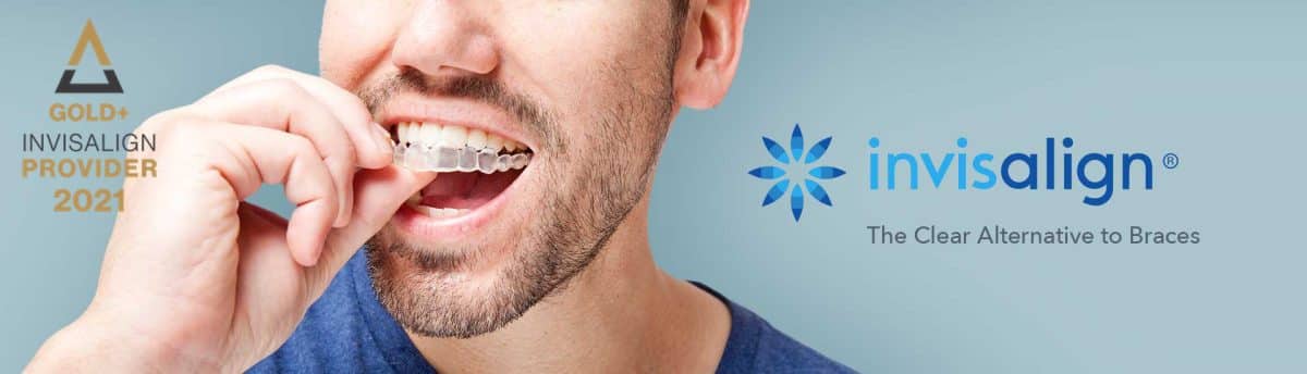 Hsa for Invisalign  : Affordable Options for a Straighter Smile